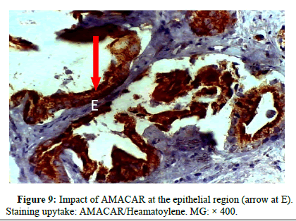 omha-normal omha-normal