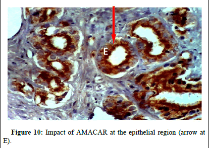 omha-normal omha-normal