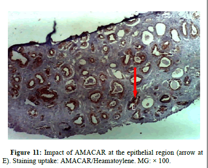 omha-normal omha-normal