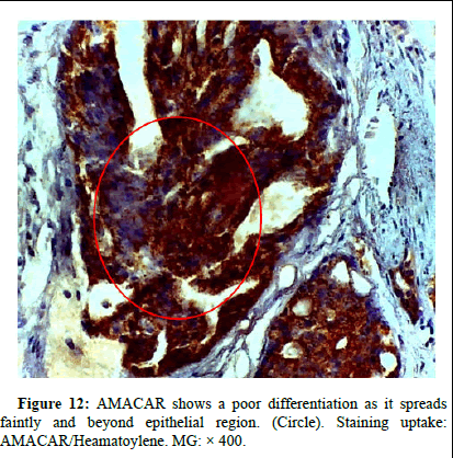 omha-normal omha-normal