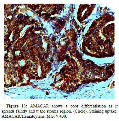 omha-normal omha-normal