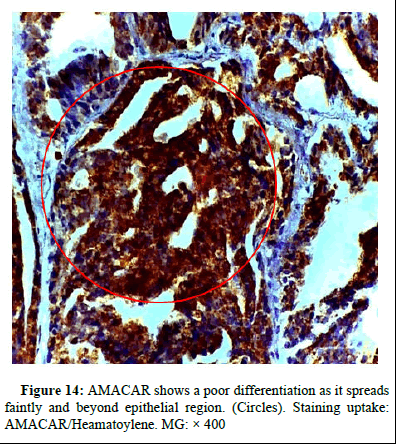omha-normal omha-normal