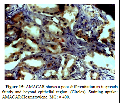 omha-normal omha-normal