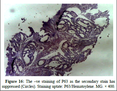 omha-normal omha-normal