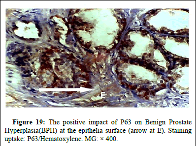 omha-normal omha-normal