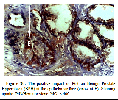 omha-normal omha-normal