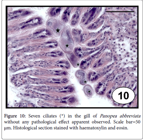 archives-parasitology-Seven-ciliates