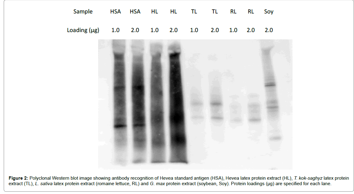biotechnology-biomaterials-Western-blot