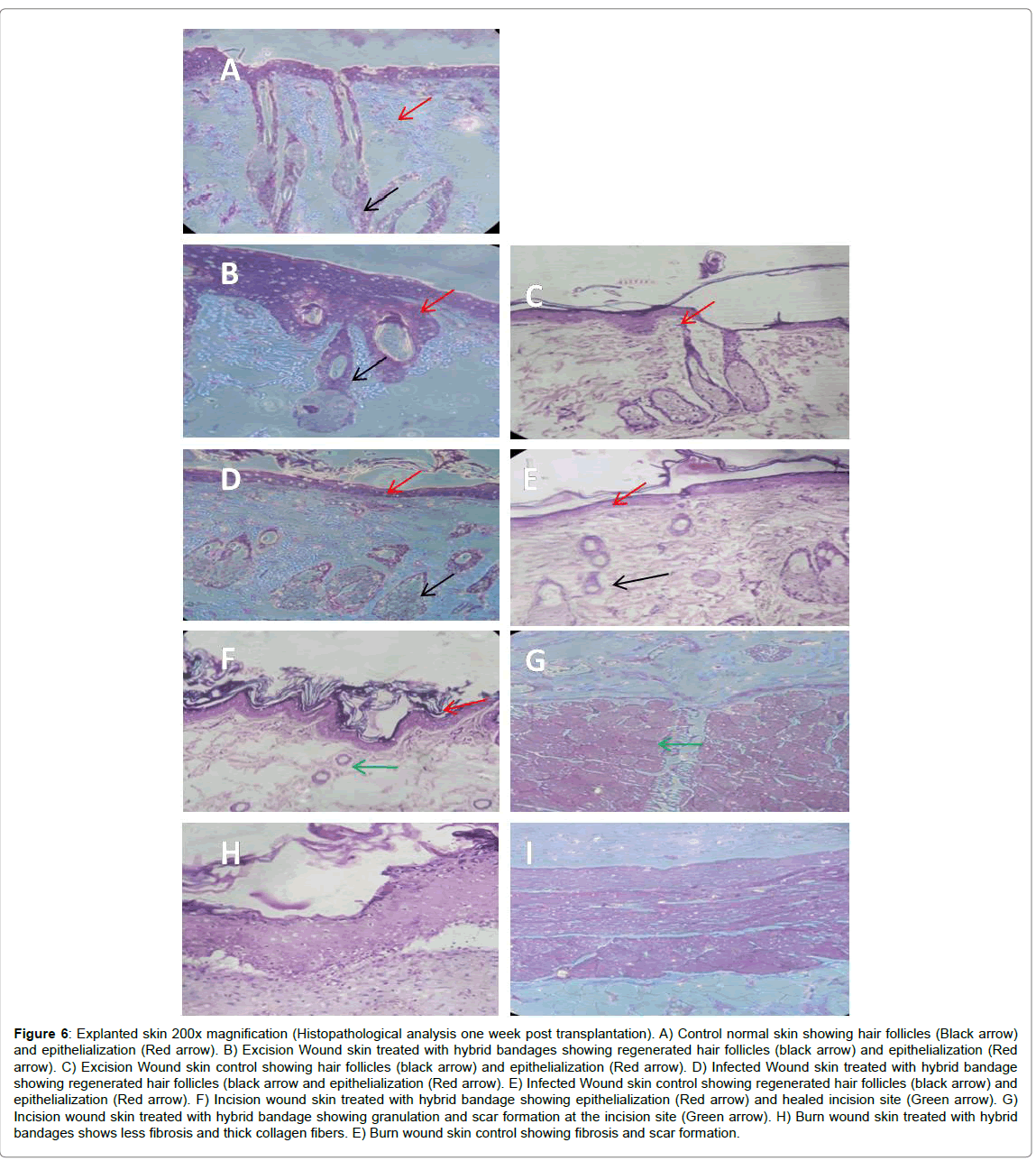 biotechnology-biomaterials-hair-follicles