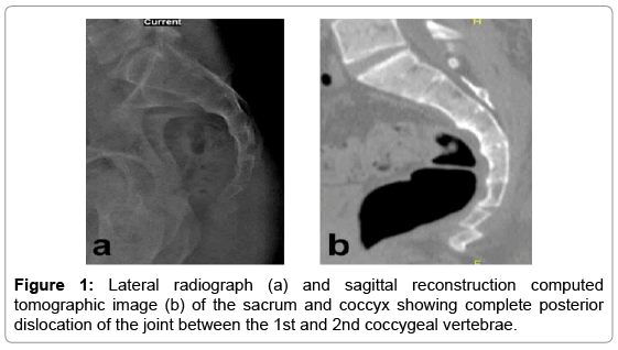 clinical-case-reports-Lateral-radiograph