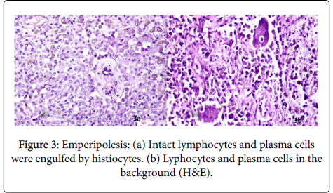 clinical-experimental-pathology-Intact-lymphocytes