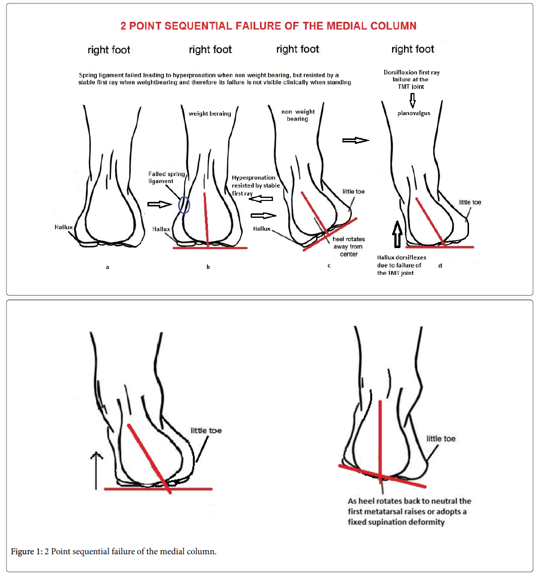 Ankle And Foot Pain Chart