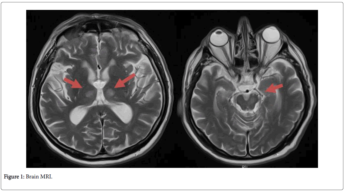 community-medicine-Brain-MRI