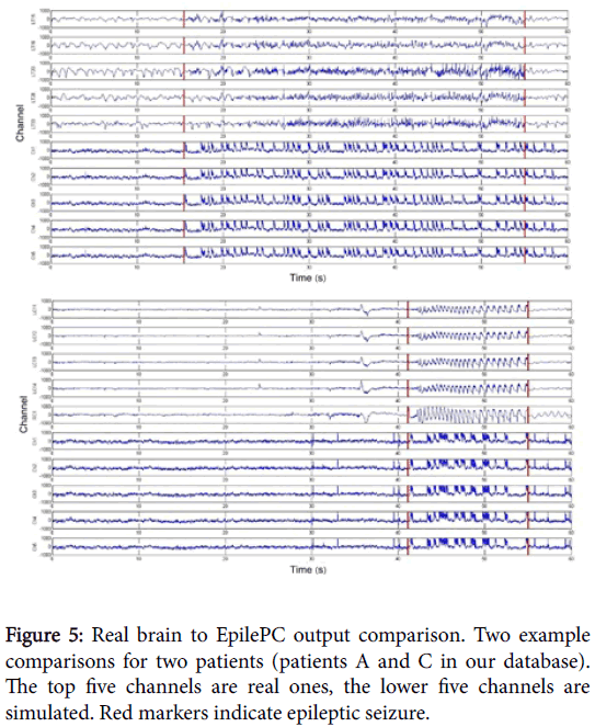 Seizure Charting Example