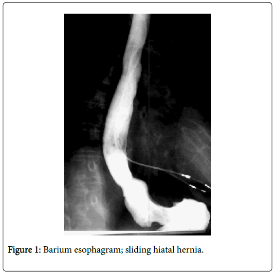 gastrointestinal-digestive-system-Barium-esophagram