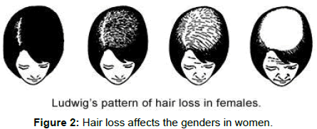 homeopathy-ayurvedic-Hair-loss-women