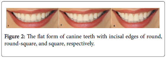 interdisciplinary-medicine-dental-science-flat-canine-teeth