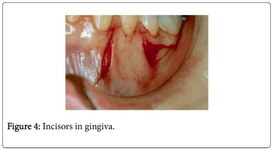 interdisciplinary-medicine-dental-science-incisors-gingiva