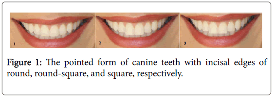 interdisciplinary-medicine-dental-science-pointed-canine-teeth