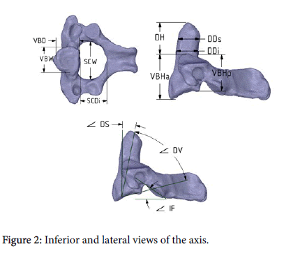 journal-spine-Inferior-lateral