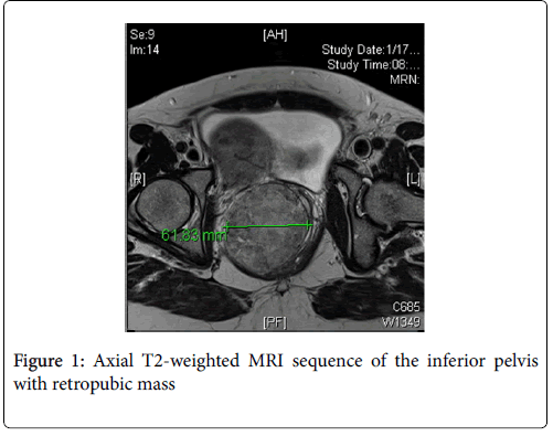 medical-surgical-pathology-MRI-sequence