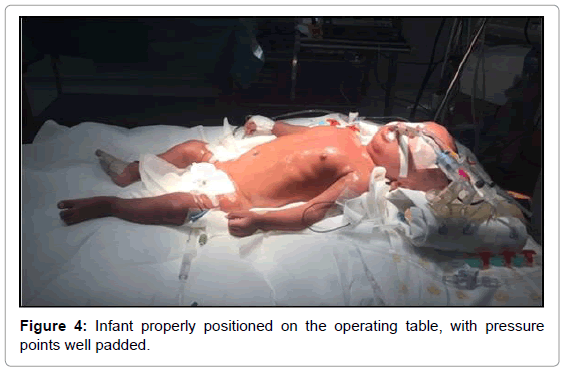 neonatal-pediatric-medicine-infant-properly-positioned
