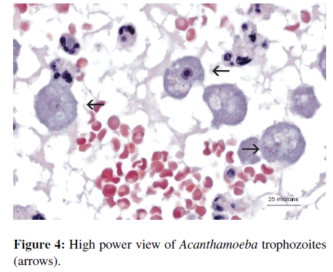 neuroinfectious-diseases-High-power