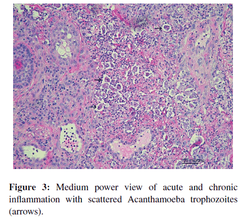 neuroinfectious-diseases-Medium-power