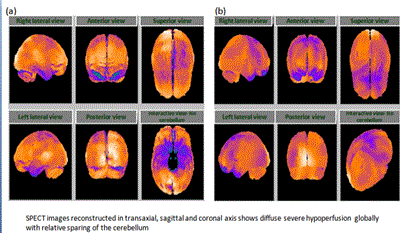 neuroinfectious-diseases-before-receiving