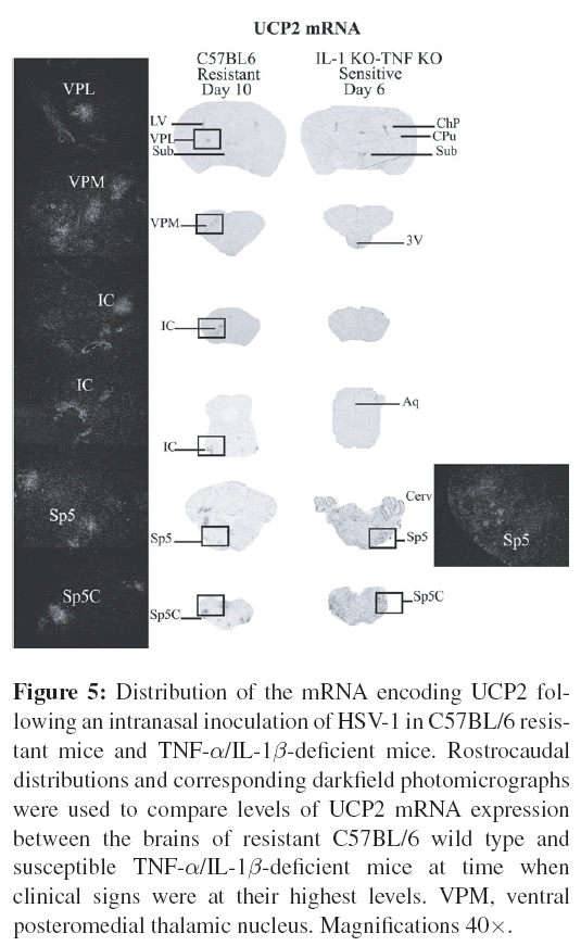 neuroinfectious-diseases-mRNA-encoding