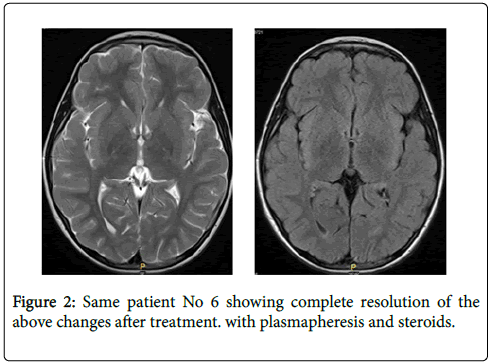 neuroinfectious-diseases-patient