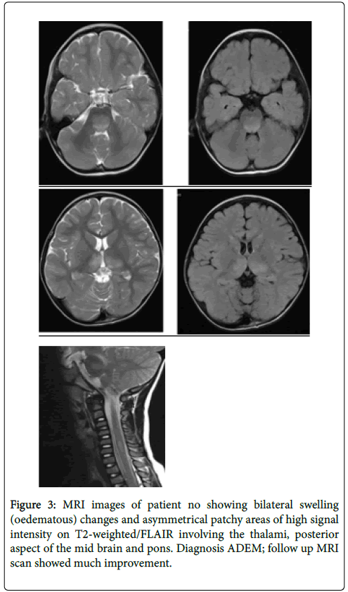 neuroinfectious-diseases-swelling