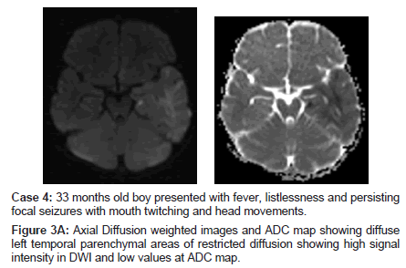 neuroinfectious-diseases-weighted-images