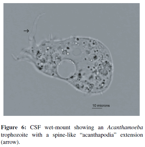 neuroinfectious-diseases-wet-mount
