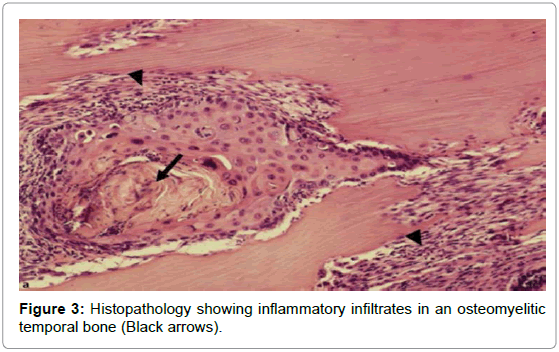 otolaryngology-Histopathology