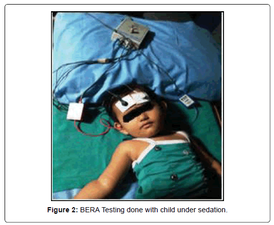 Otolaryngology: Open Access - Mapping Auditory Maturation from Neonates to  Toddlers using Electrophysiological Responses of the Brainstem