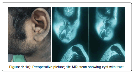otolaryngology-open-access-preoperative-picture