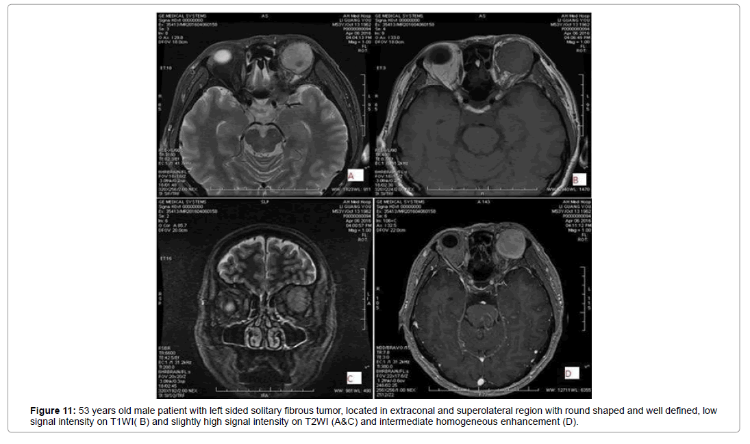 diagram of traditional mri wiring diagram all data Diagram of Reticular Formation valuation of four quadrant location method in diagnosis and mri spine diagram diagram of traditional mri