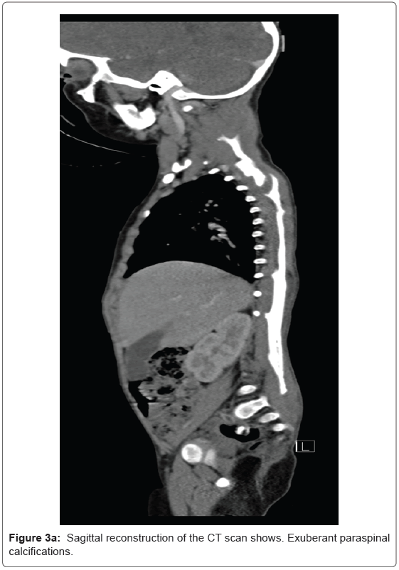 radiology-Sagittal-reconstruction