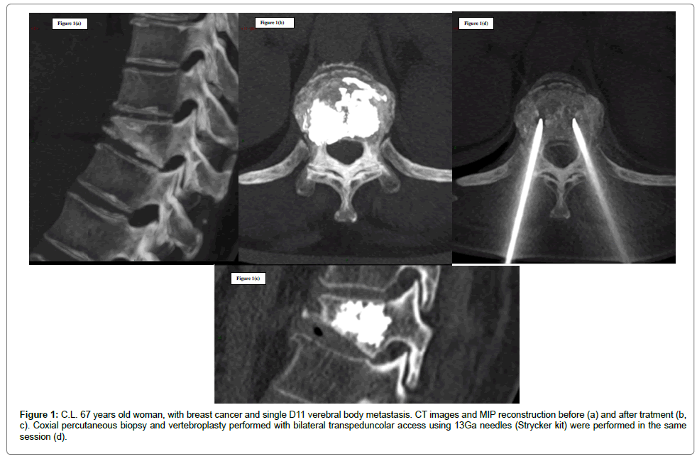 how to detect covid 19 at home