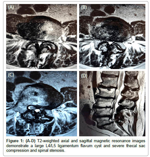 spine-sagittal-magnetic